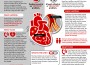 Cardiac+Arrest+vs+Heart+Attack+Infographic